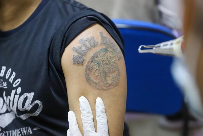 Sambut Ramadan 2026: Ratusan Warga Antusias Ikuti Layanan Hapus Tato Gratis Baznas DKI Jakarta, Ini Jadwal dan Syaratnya!