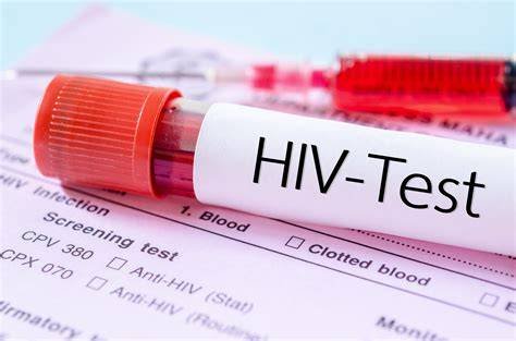 Viral Isu 522 Pelajar Terpapar HIV di Sidoarjo, Kemenkes dan Dinkes Ungkap Fakta Sebenarnya